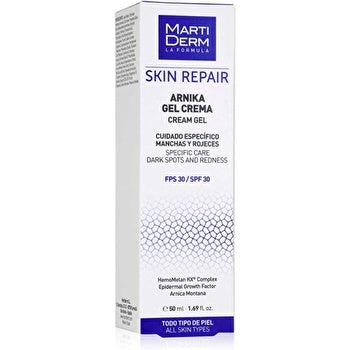 Martiderm Arnika Cream Gel 50ml
