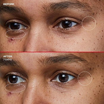 Shiseido Benefiance Wrinkle Smoothing Eye Cream 15ml