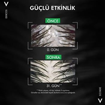 Vichy Dercos Anti-dandruff Shampoo 390ml